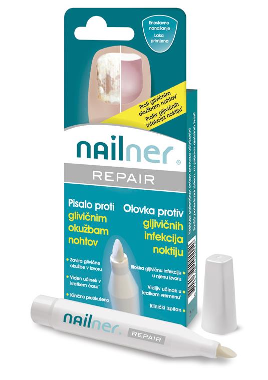 nailner-repair-1