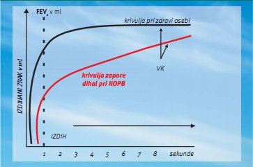 spirogram