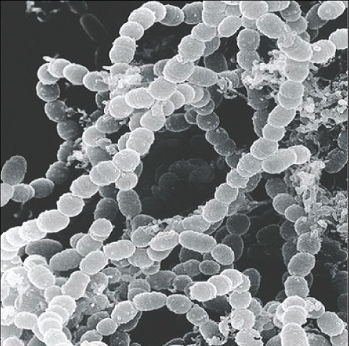 uz-bakterije-1