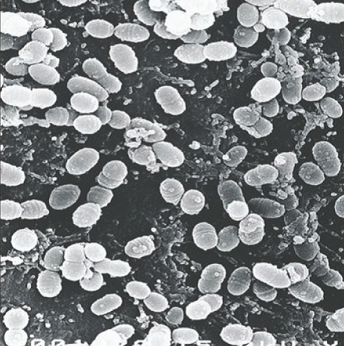 uz-bakterije-2
