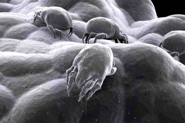 Vir: https://sleepworks.com/resource/sleep-health/dust-mites