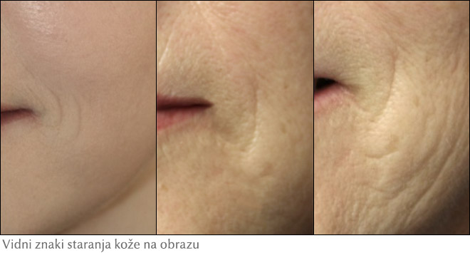 vidni znaki staranja koze na obrazu