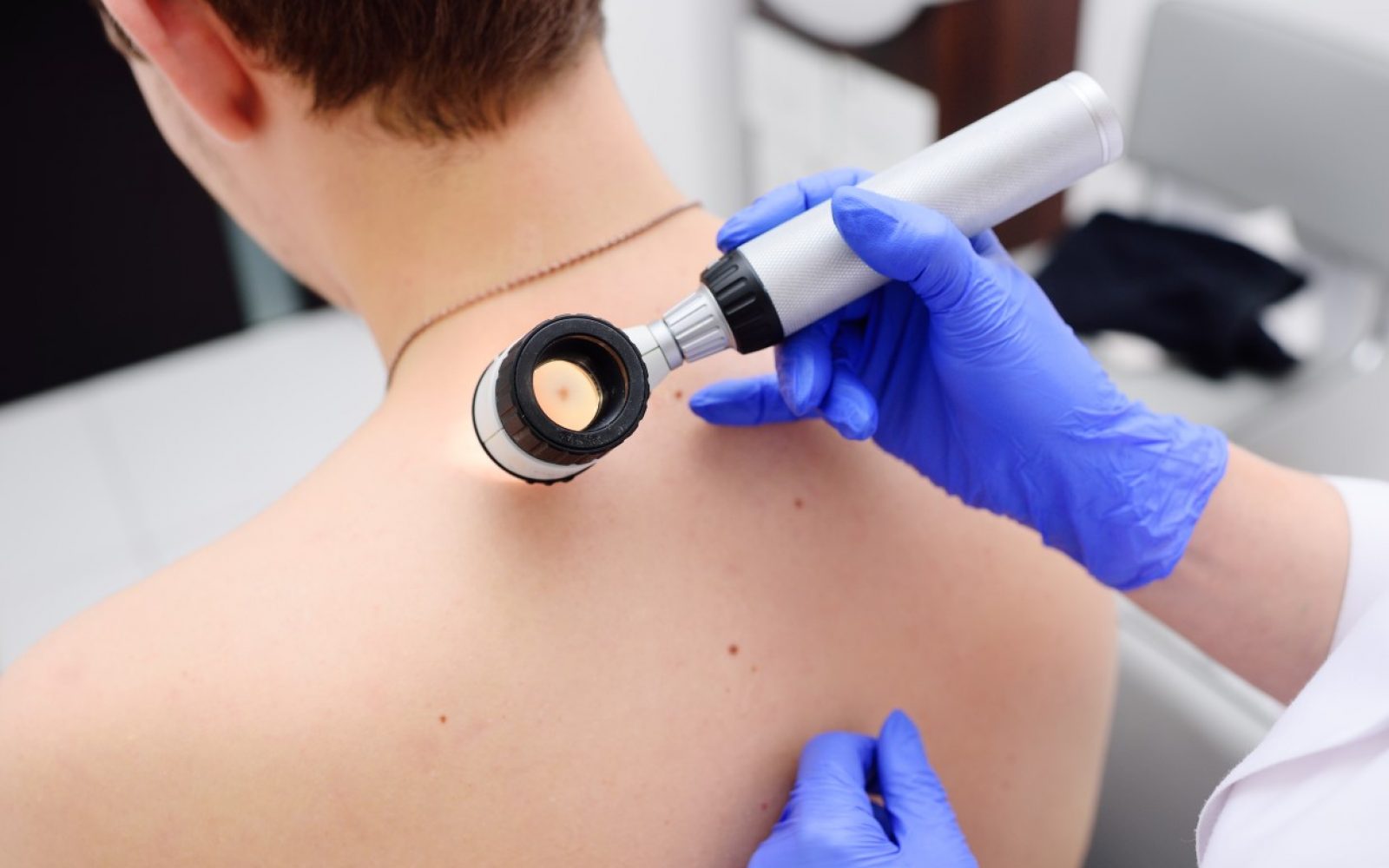 Estetika Milosevic - pregled kozni rak