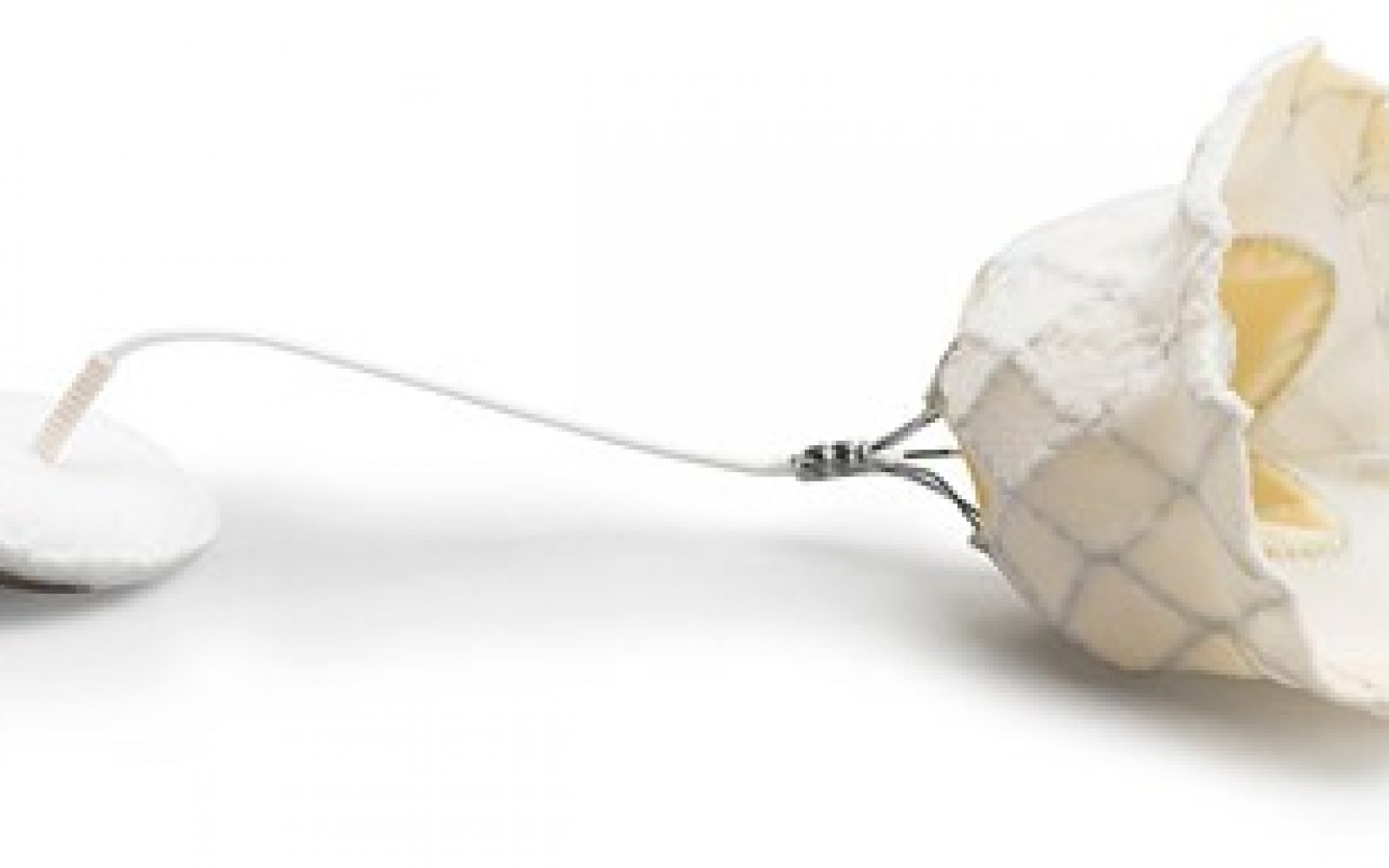 Transkatetrska mitralna zaklopka