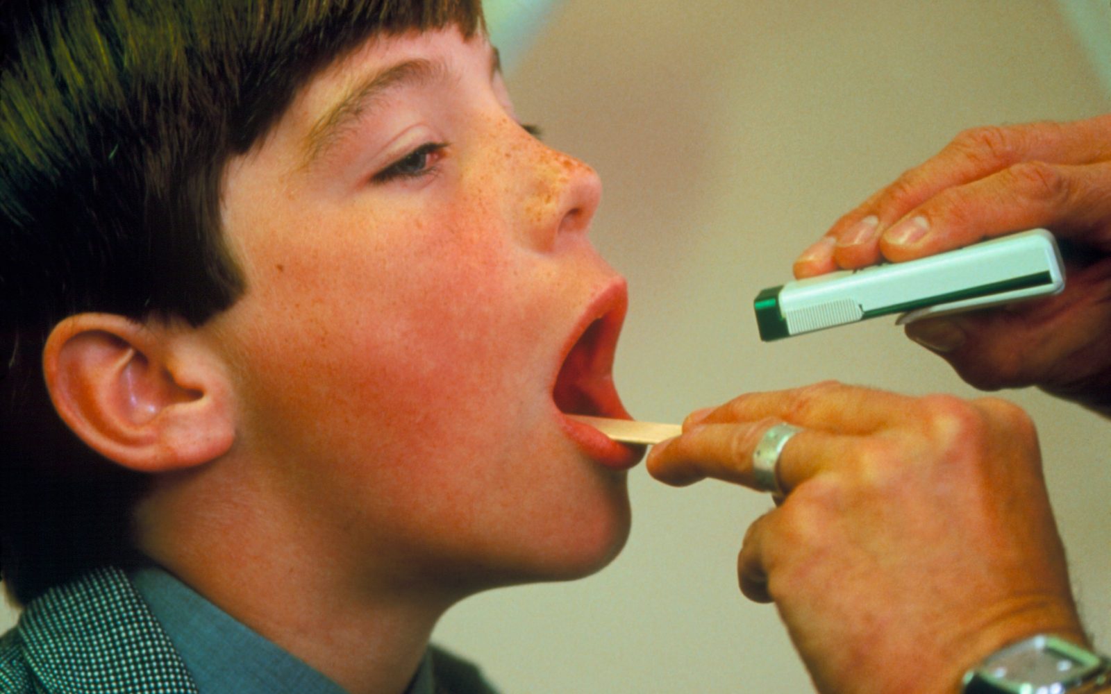 Zdravnik gleda grlo bolnemu otroku