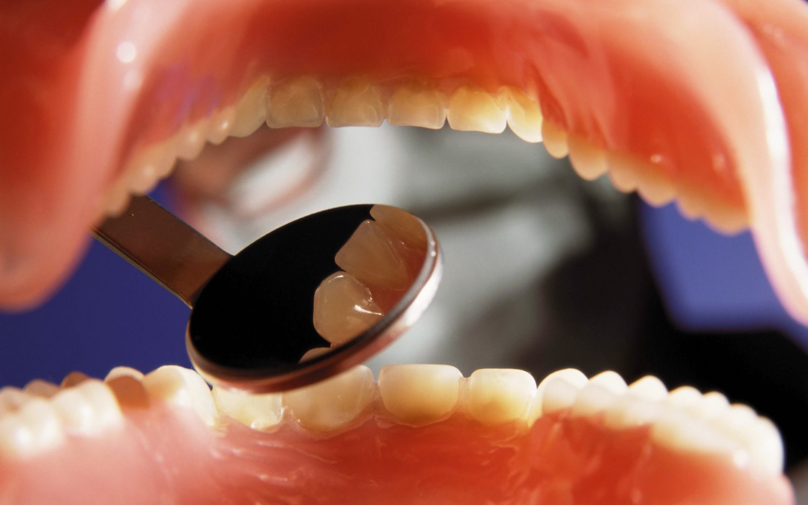 Pregled zob z ogledalcem.