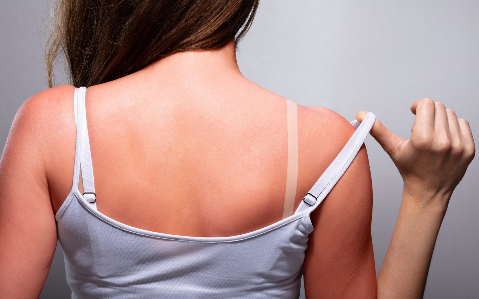 Zato ji je svetoval, da se sonči 4 ure na dan, od 11.00 do 15.00.