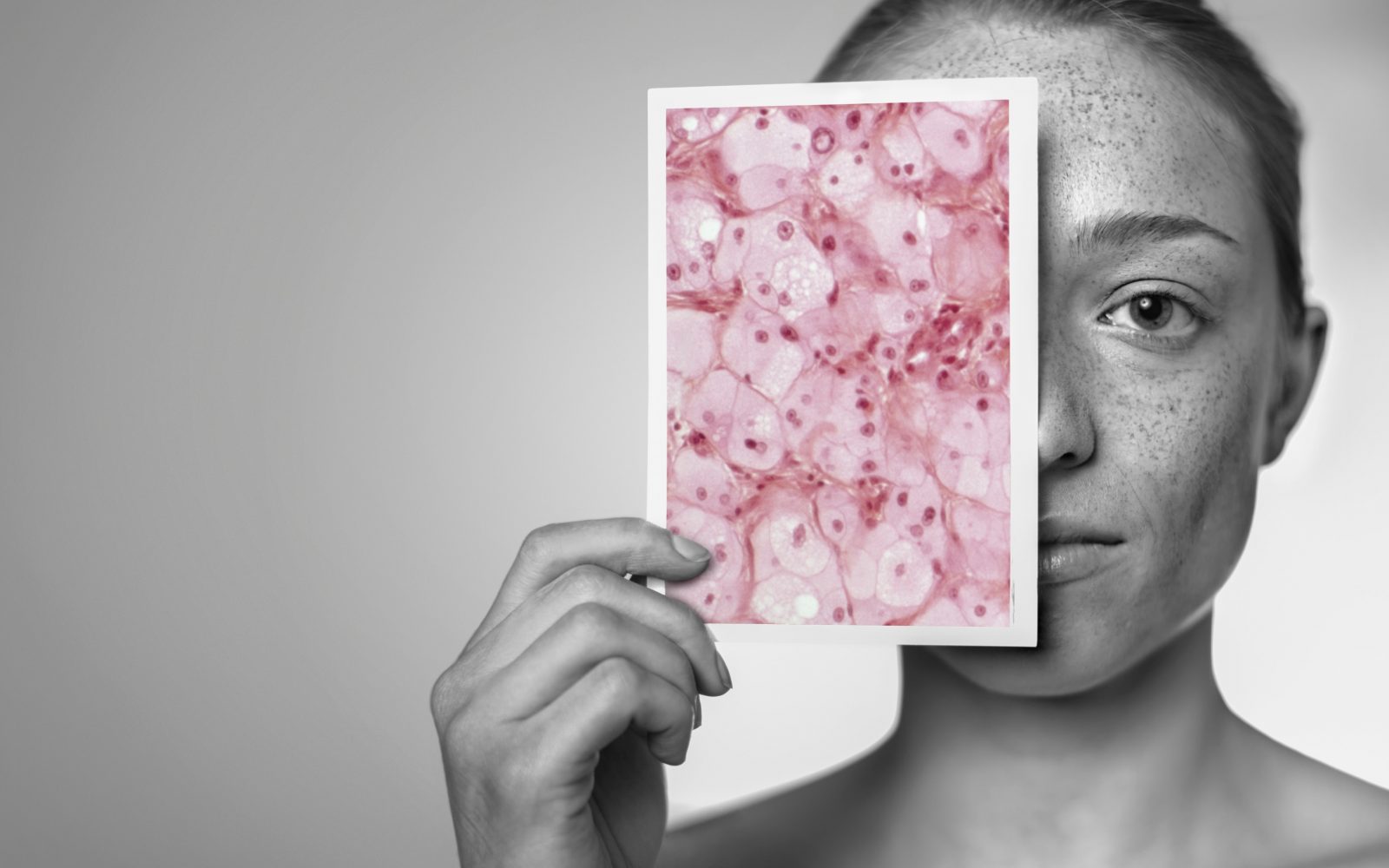 Poškodbe zaradi sonca. Ženska, ki si pred obrazom drži svetlobni mikrofoto posnetek, na katerem so vidne poškodbe, ki jih je na njeni koži povzročilo sončenje.