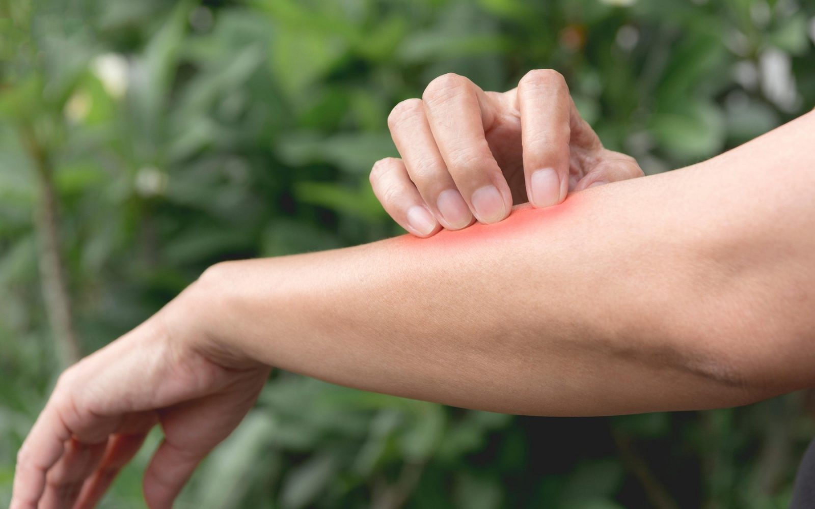 Ključne sestavine za regeneracijo in zaščito kože poleti