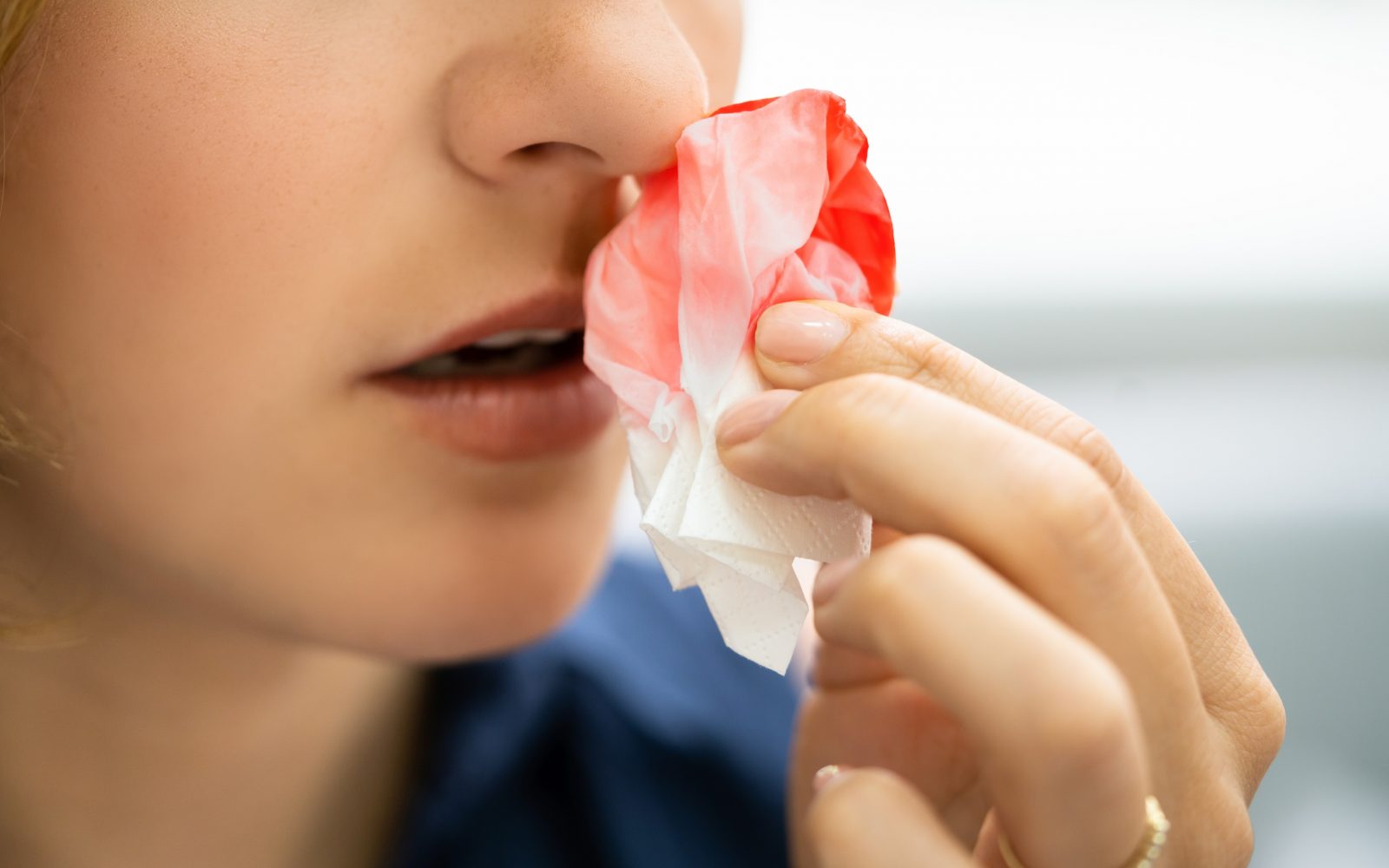 Ženska ustavlja krvavitev iz nosu