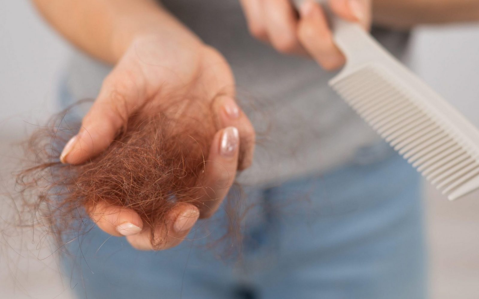 lasje, izpadnje las, ženska