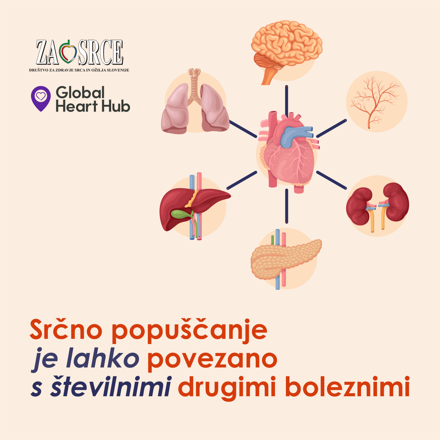 srčno popuščanje - infografika