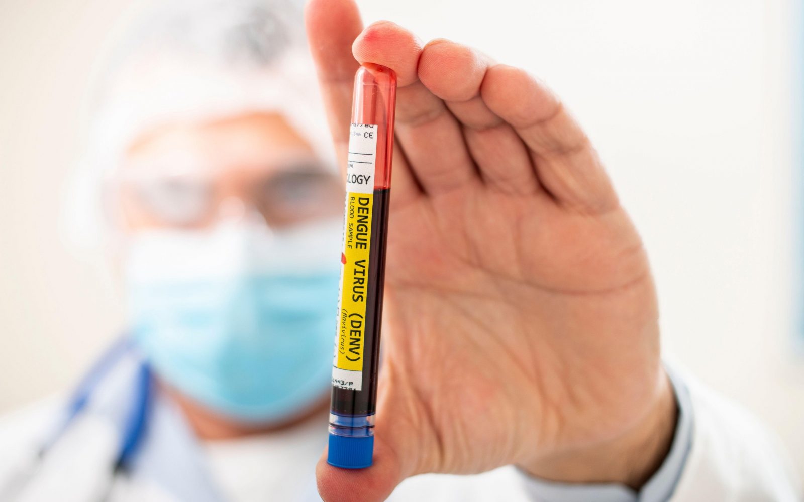 Fotografija prikazuje zdravstvenega delavca v zaščitni maski in očalih, ki v roki drži epruveto z vzorcem krvi, označeno z nalepko "Dengue Virus (DENV)". Epruveta je v ospredju in jasno vidna, medtem ko je obraz zdravstvenega delavca rahlo zamegljen v ozadju. Slika je idealna za članke o diagnostiki, testiranju in preprečevanju virusnih okužb, posebej virusa dengue. Uporabna je tudi za medicinske bloge, spletne strani zdravstvenih klinik in publikacije o nalezljivih boleznih.