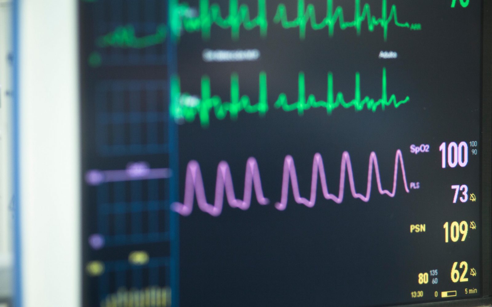 Prebojni napredek v zdravljenju življenje ogrožajočih motenj srčnega ritma