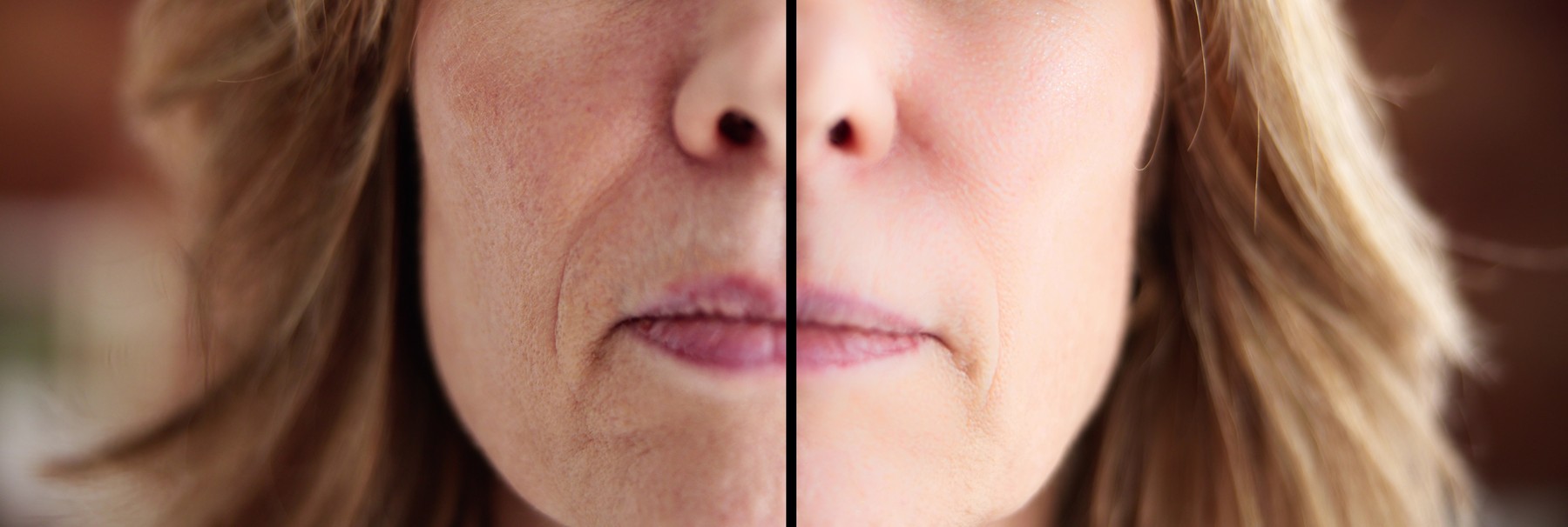 vlaženje kože, pred in po, nega kože, zmanjšanje gub, gladka koža, hidracija kože, primerjava kože, suha koža, nega obraza, učinkovitost vlažilne kreme