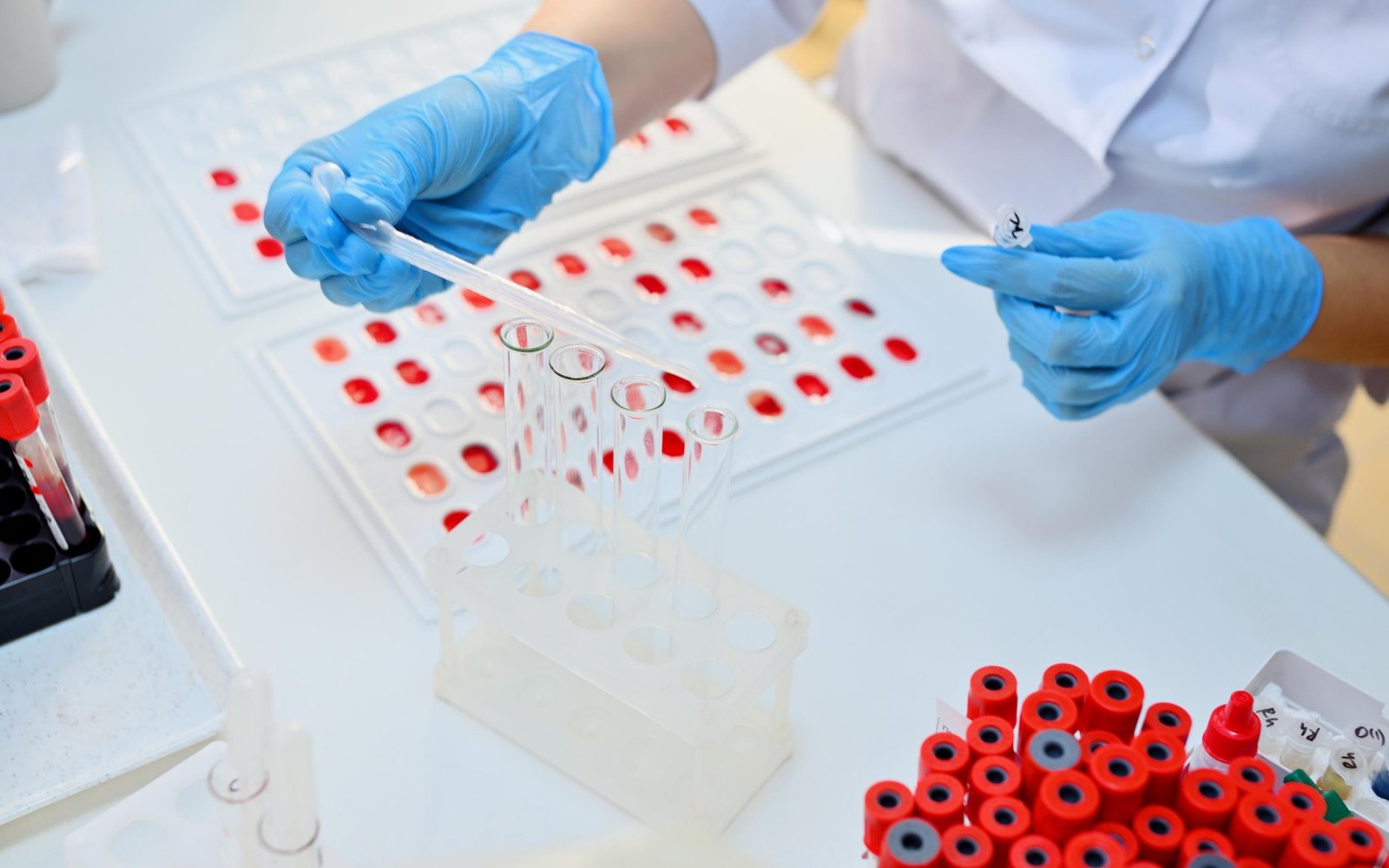 Zdravstveni delavec z zaščitnimi rokavicami izvaja laboratorijsko testiranje krvnih vzorcev, namenjeno določanju krvne skupine. Na mizi so epruvete, pipete in pladnji z rdečimi označbami.