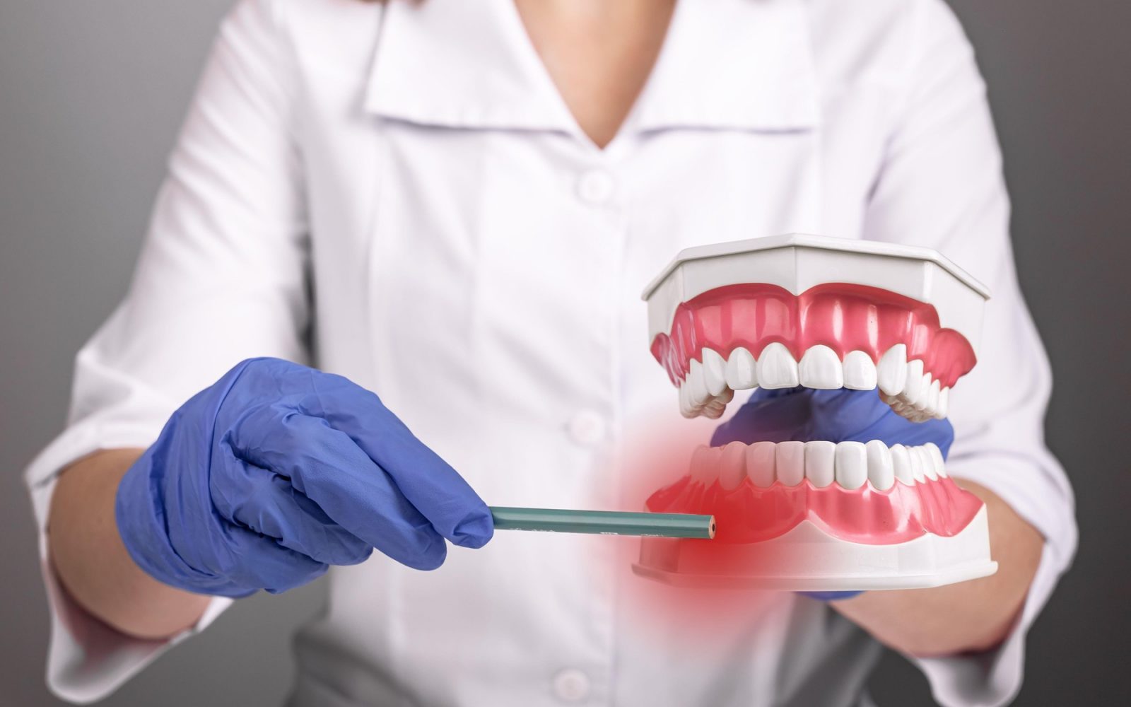 Zobozdravnik prikazuje model dlesni z vnetjem – prikaz posledic parodontalne bolezni