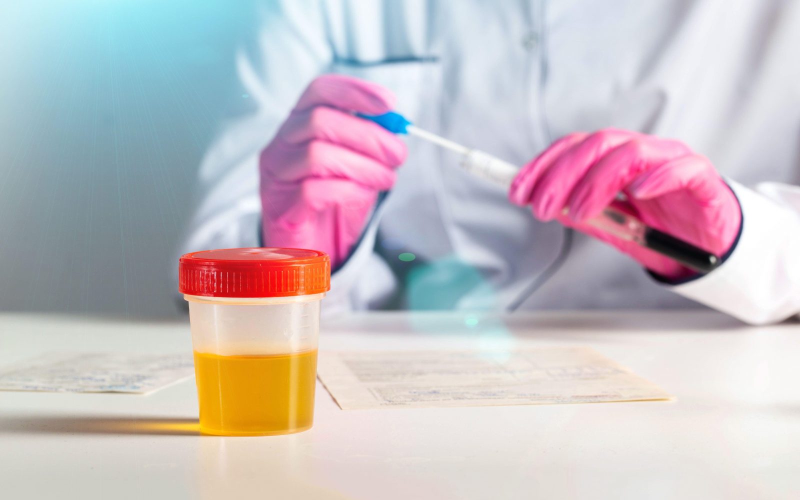 Urin v lončku, pripravljen na analizo, simbolni prikaz hematurije (kri v urinu)