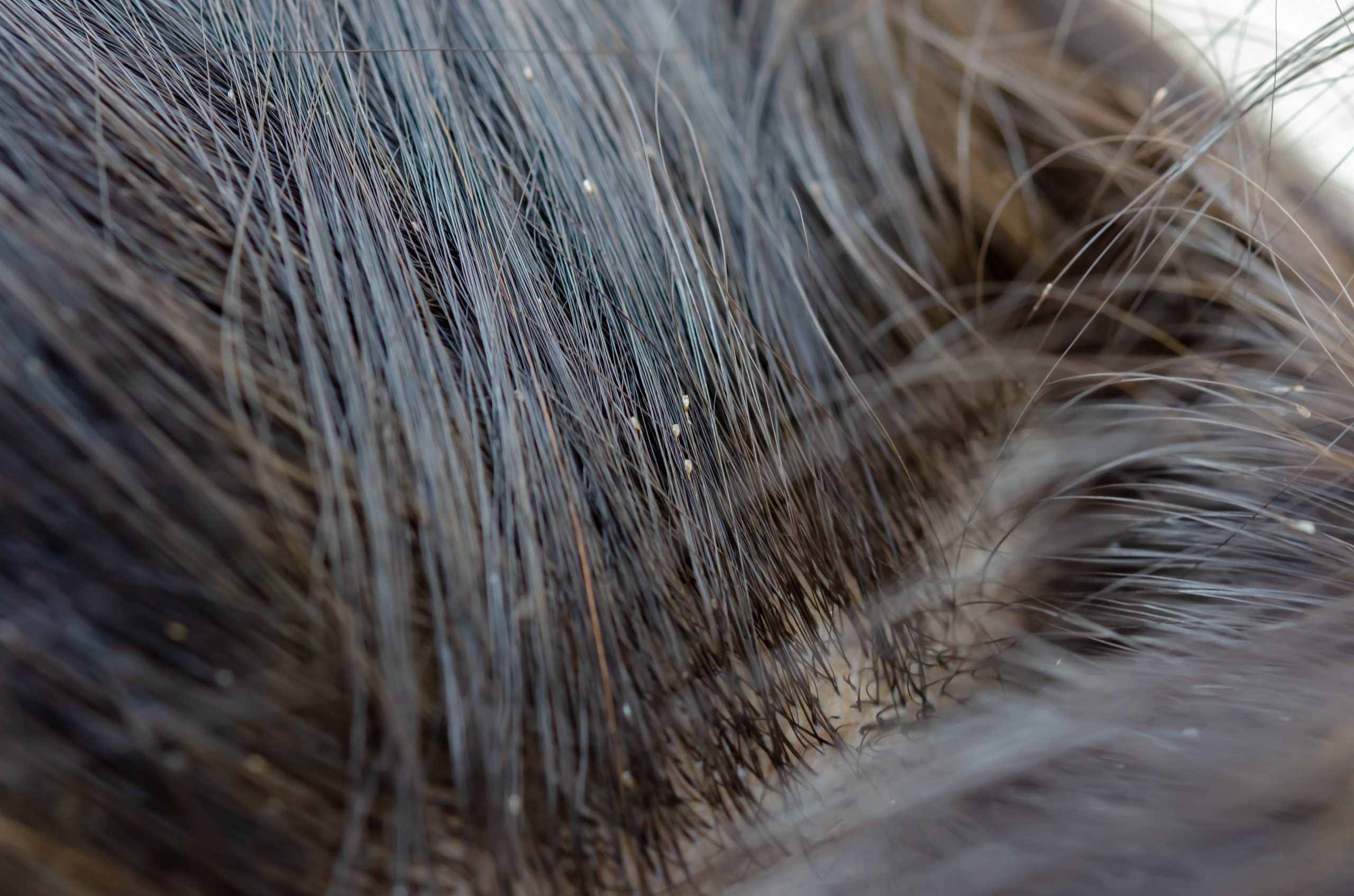 v laseh pritrjene gnide naglavnih uši, kako zgledajo gnide