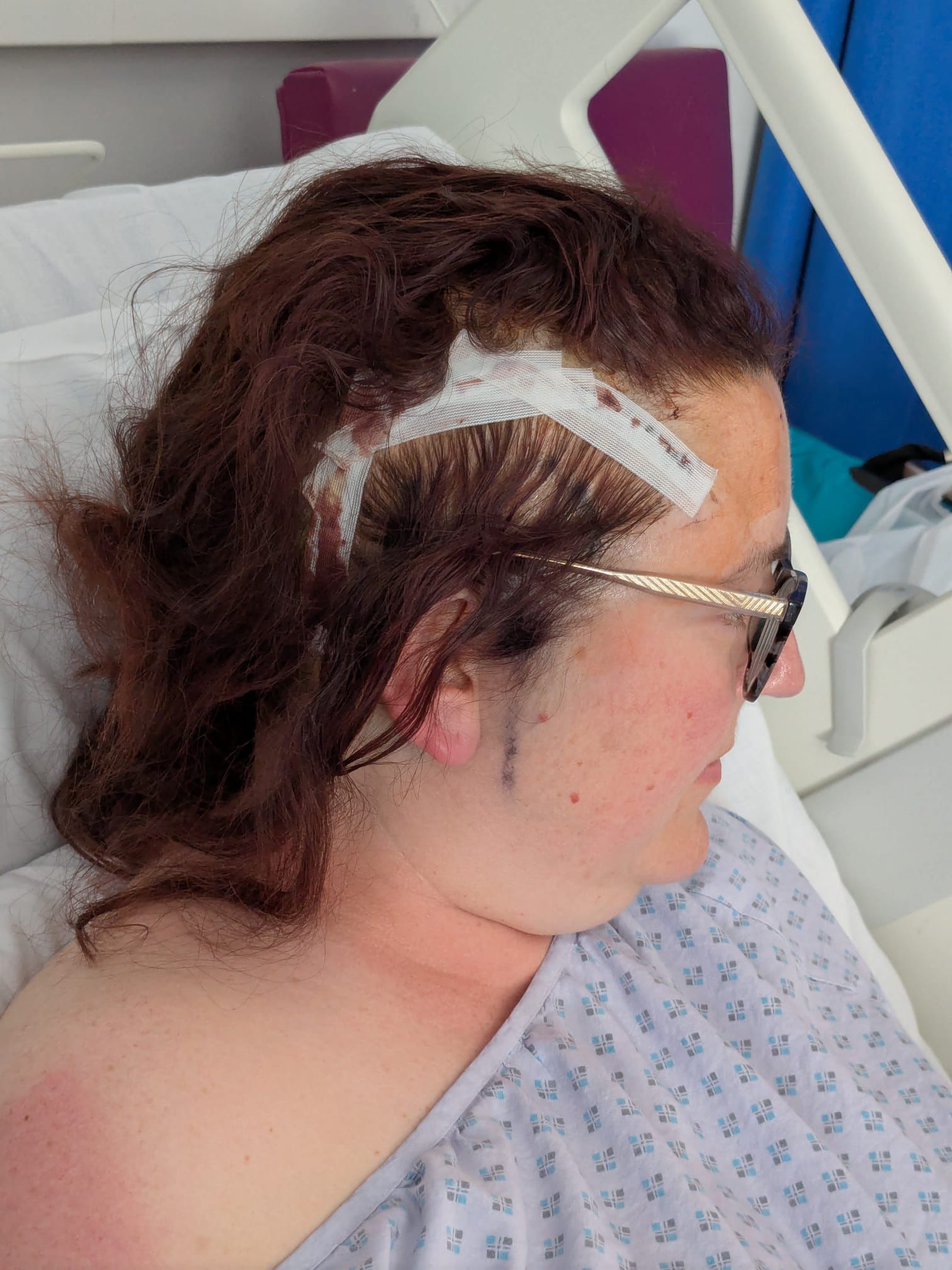 Sarah Hitchman, 43-letna učiteljica, ki je simptome možganskega tumorja sprva pripisovala perimenopavzi.