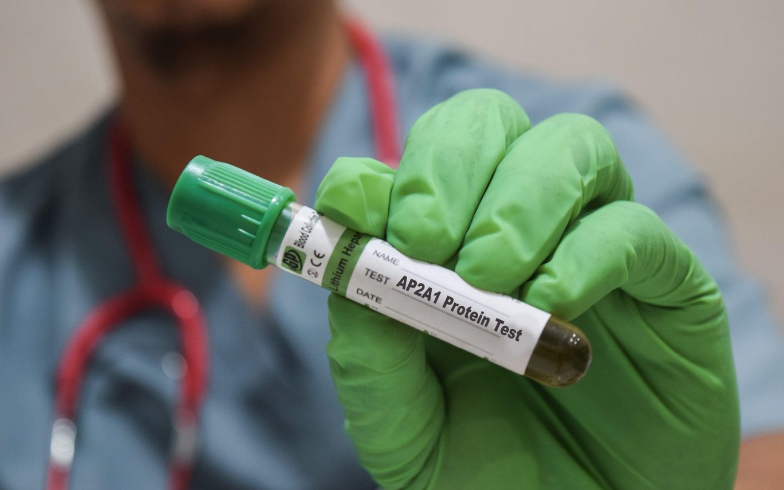 Znanstvenik drži epruveto z zeleno tekočino – simbolično za raziskave pomlajevanja celic (AP2A1 protein)