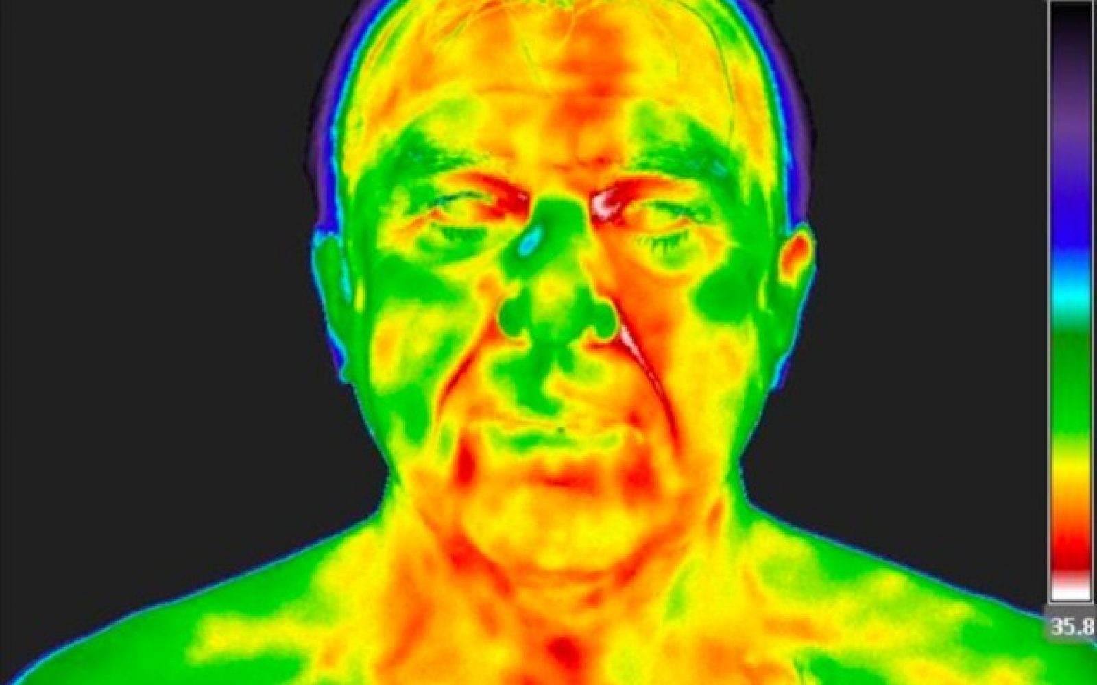medicinska termografija. Vibrium