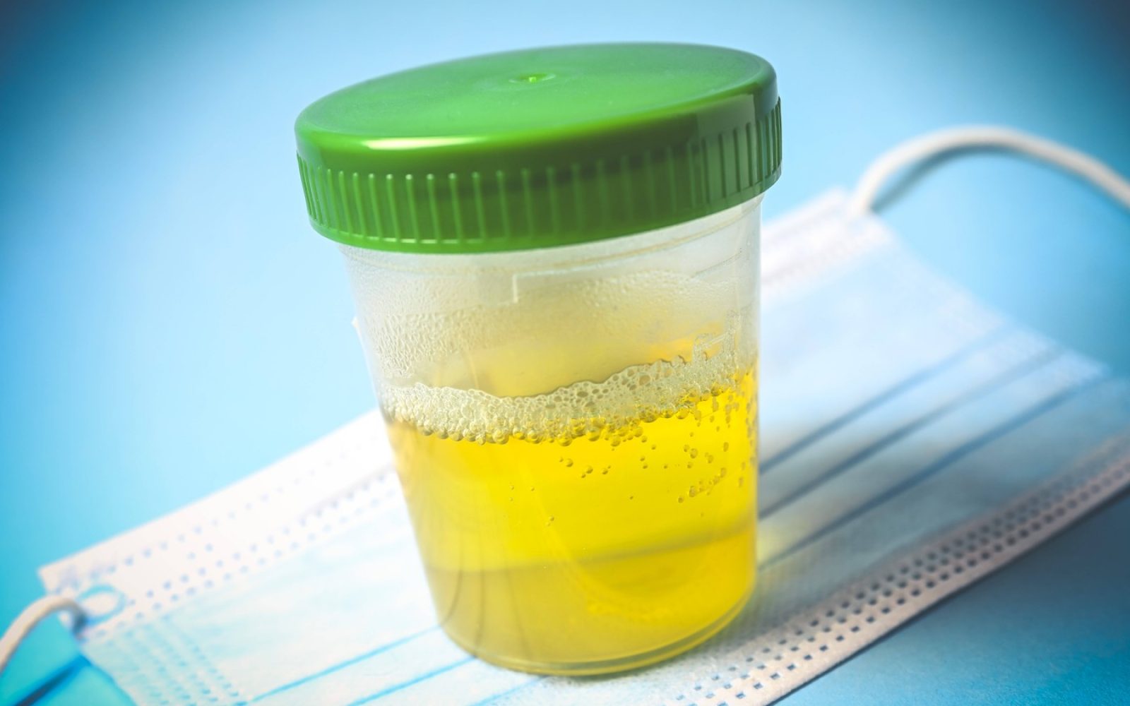 "Zakaj urin smrdi – vzroki, ki jih morate poznati"