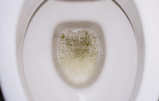 Penast urin v straniščni školjki - vzroki in simptomi