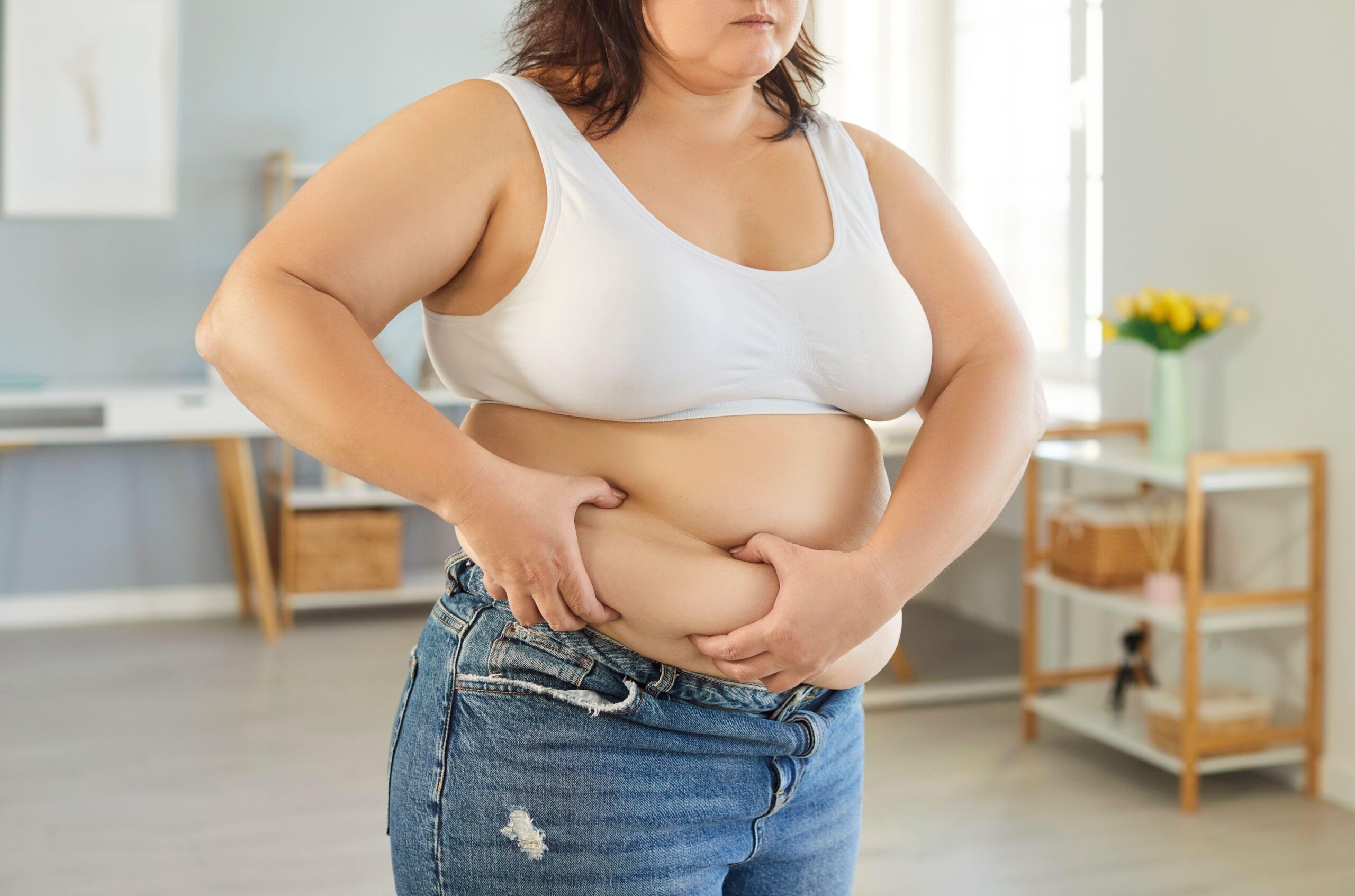 Ženska s prekomerno telesno težo se drži za maščobno tkivo na trebuhu