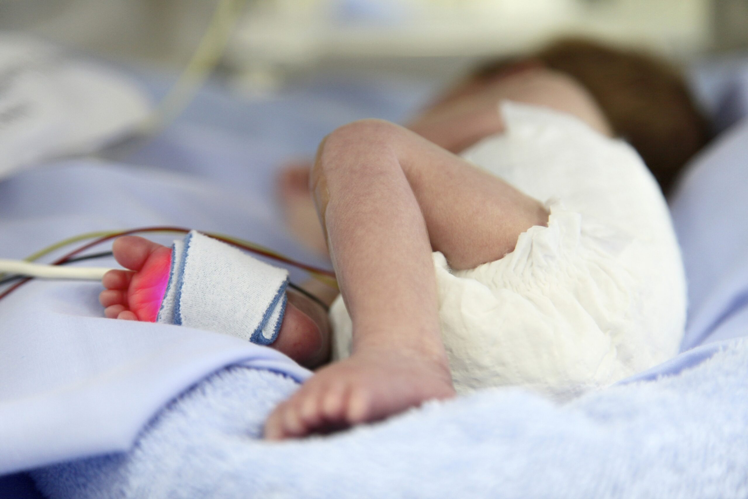 Nedonošenček na neonatalni intenzivni negi