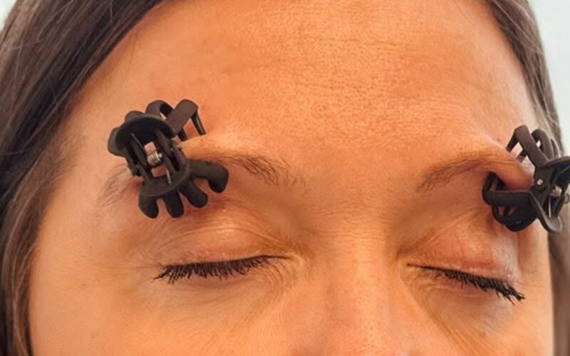 Ženska s sponkama na obrveh med migrenskim glavobolom