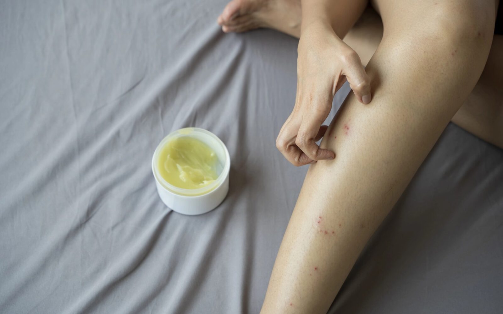 Pri vztrajnem srbenju lahko pravilna nega pomaga, v nekaterih primerih pa je potreben tudi obisk zdravnika.