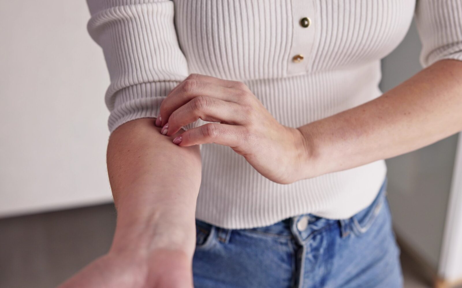 Ženska si praska roko zaradi srbenja kože brez vidnih izpuščajev