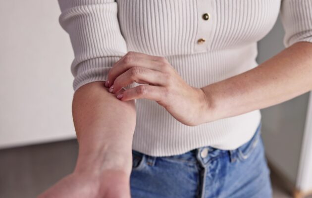 Ženska si praska roko zaradi srbenja kože brez vidnih izpuščajev