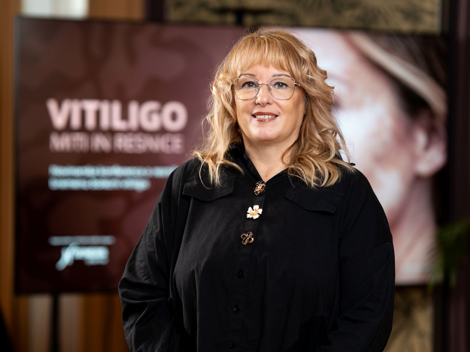 Nika Vrbinc Mihelič, bolnica z vitiligom