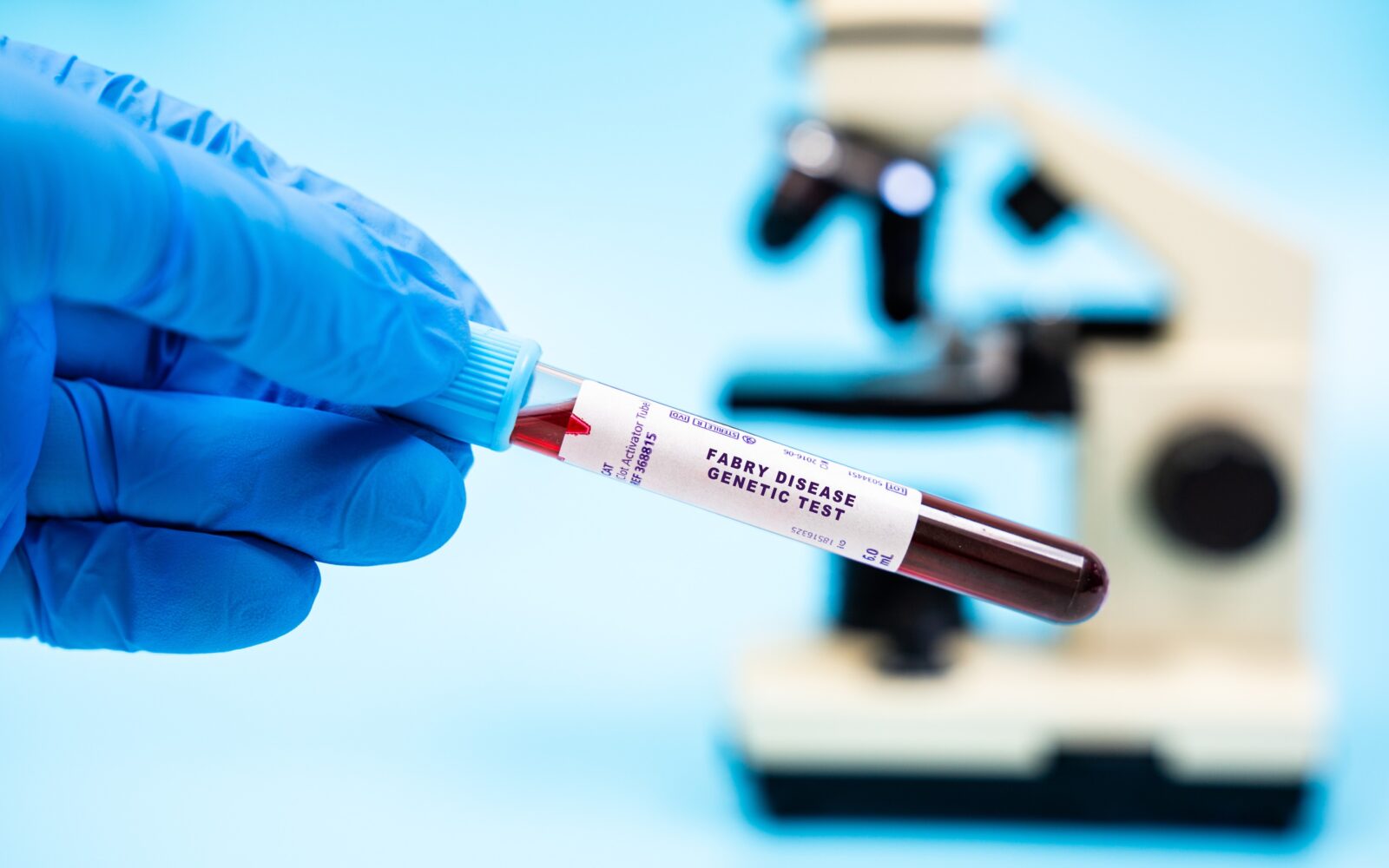 Genetski test za Fabryjevo bolezen
