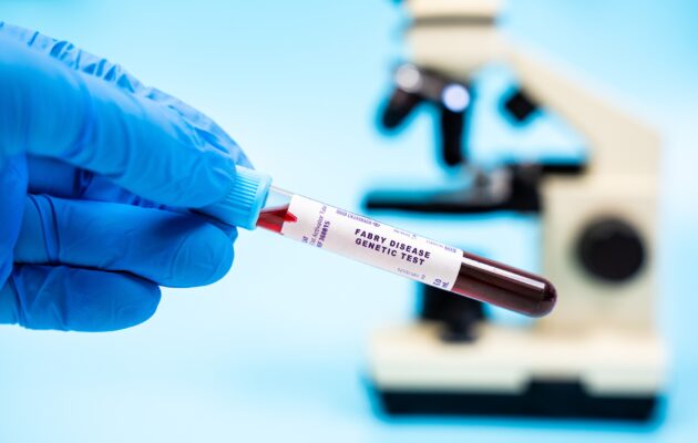 Genetski test za Fabryjevo bolezen