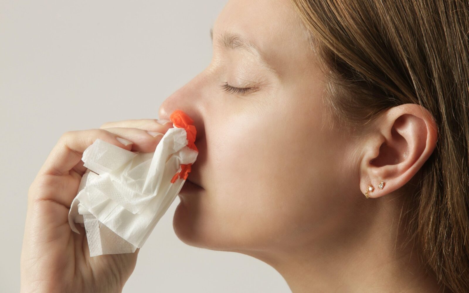 Prva pomoč pri krvavitvah iz nosu - kako pravilno zaustaviti krvavitev