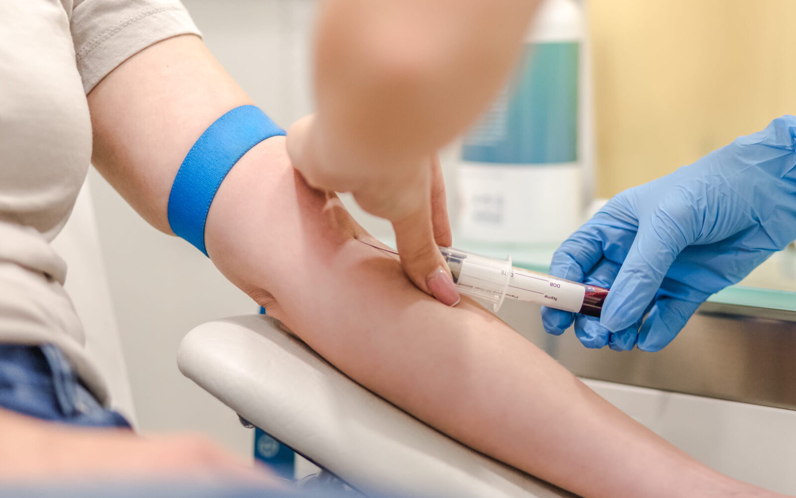 kri, krvne preiskave, hormoni