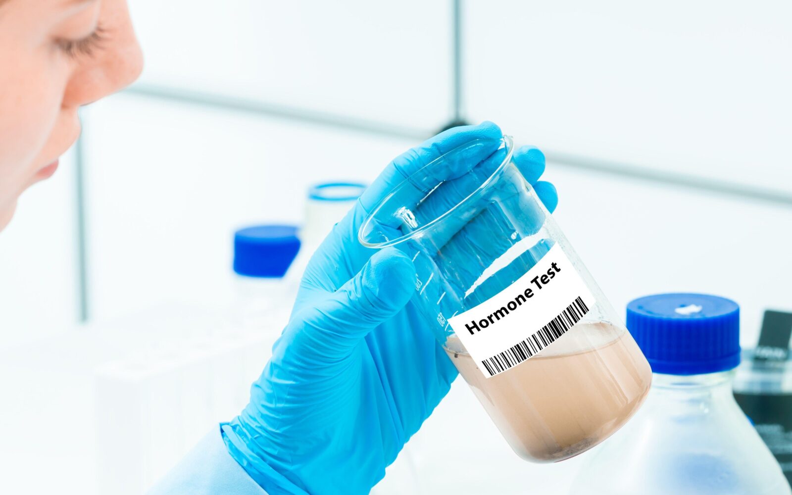 kri, krvne preiskave, hormoni