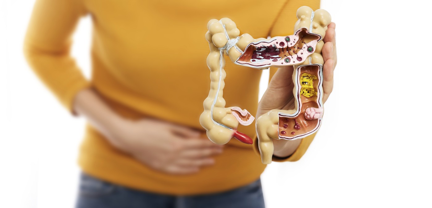 Model človeškega črevesja