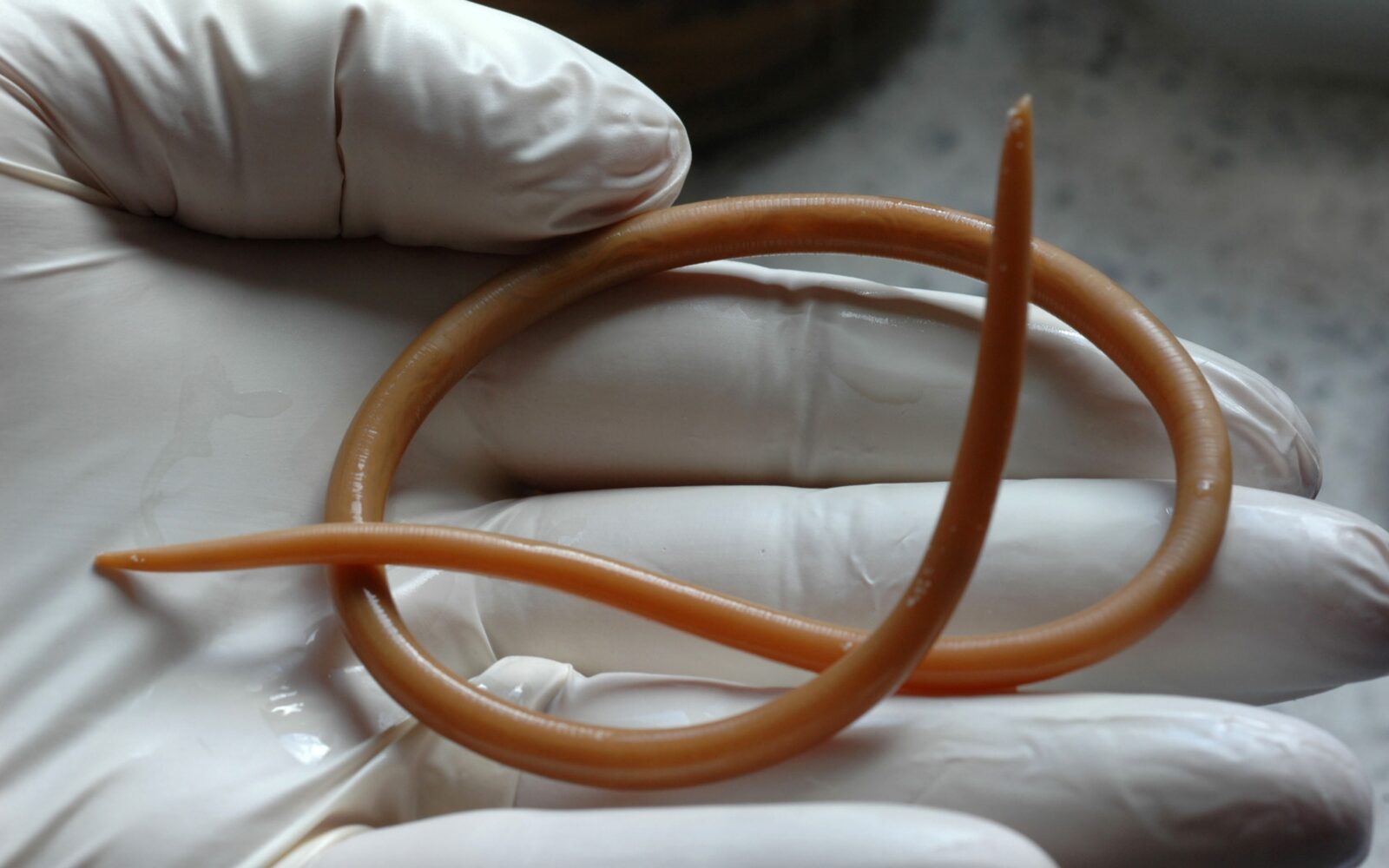 Odrasla glista Ascaris lumbricoides v rokavičkah zdravnika