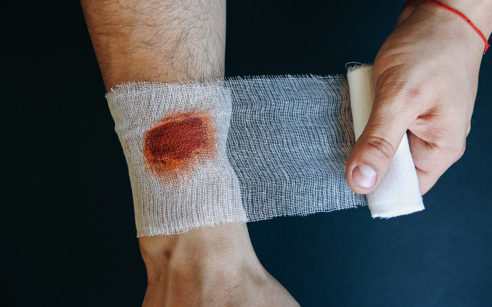 Moški si z gazo povija krvavečo rano na zapestju