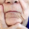 Starejša ženska z bolečim izrazom na obrazu, znak bolečine pri demenci
