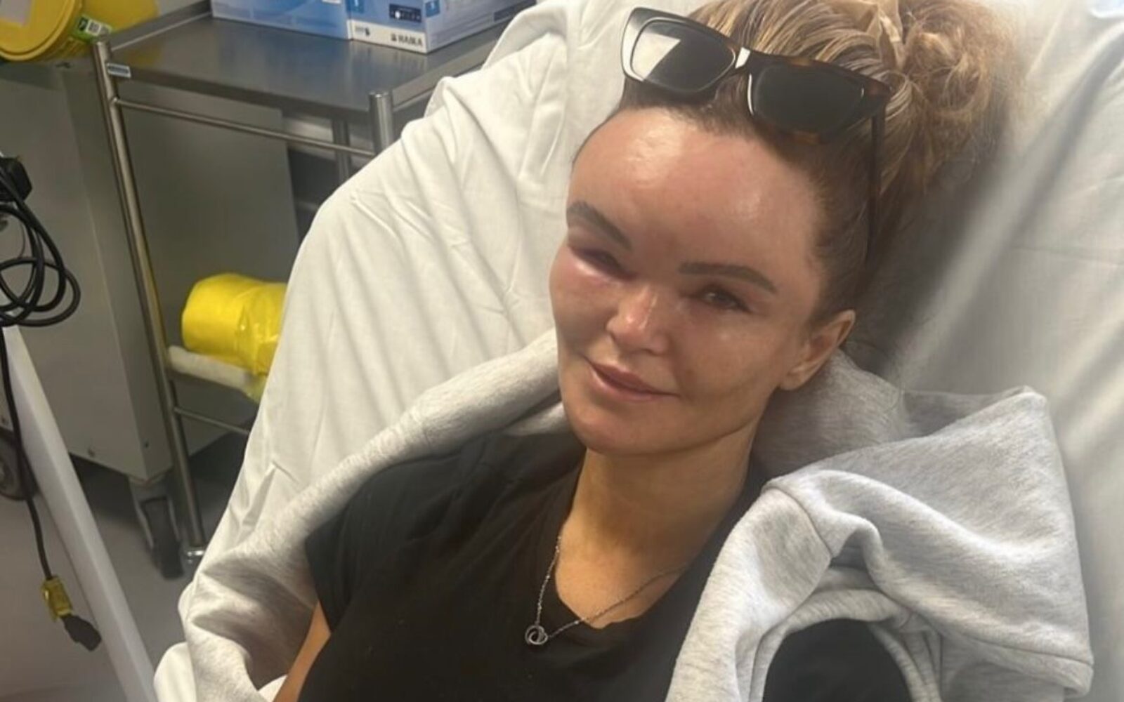 Claire Titterington, učiteljica športne vzgoje s hereditarnim angioedemom, ki povzroča hudo otekanje obraza, okončin in notranjih organov, v bolnišnici, čakajoč diagnozo