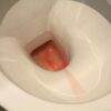 wc školjka, v kateri je vidna kri v urinu