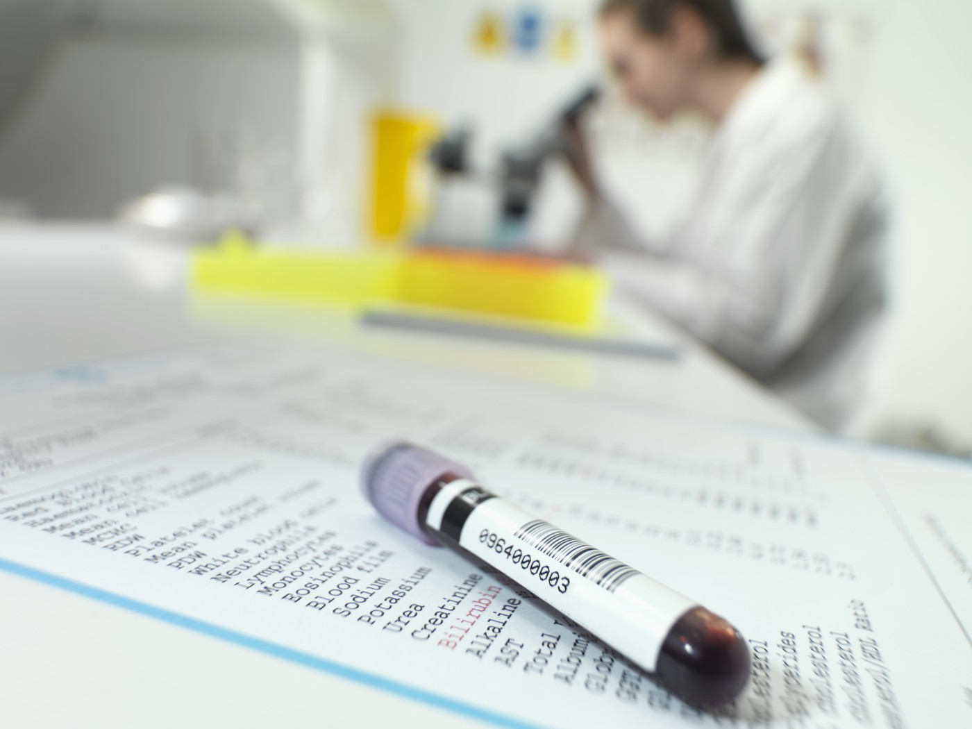 Ali krvni test pokaže pomanjkanje magnezija?