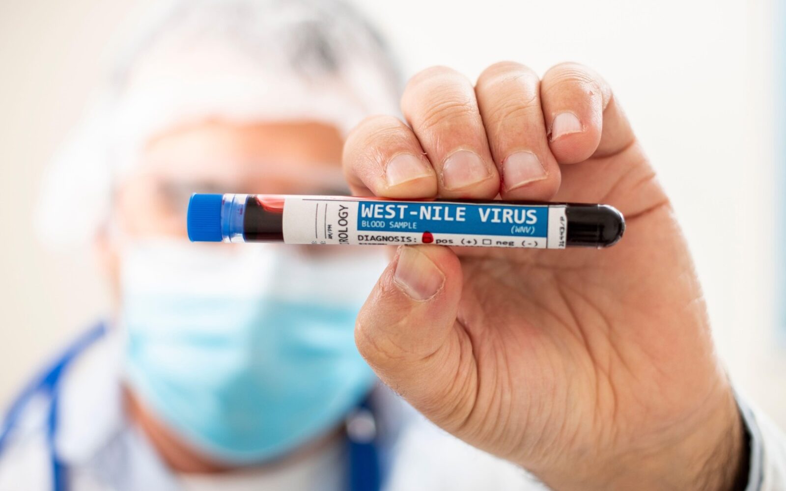 Zdravstveni delavec drži epruveto z oznako West Nile Virus.
