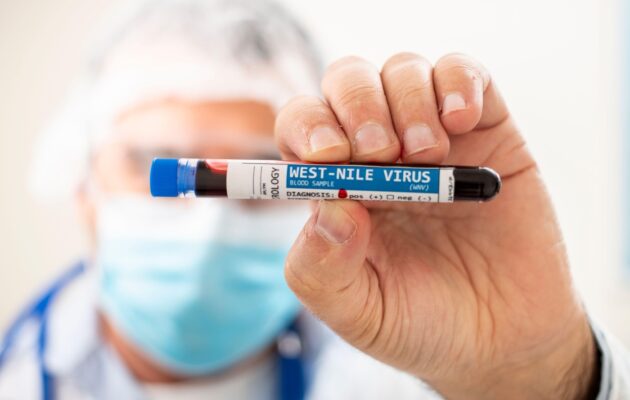 Zdravstveni delavec drži epruveto z oznako West Nile Virus.