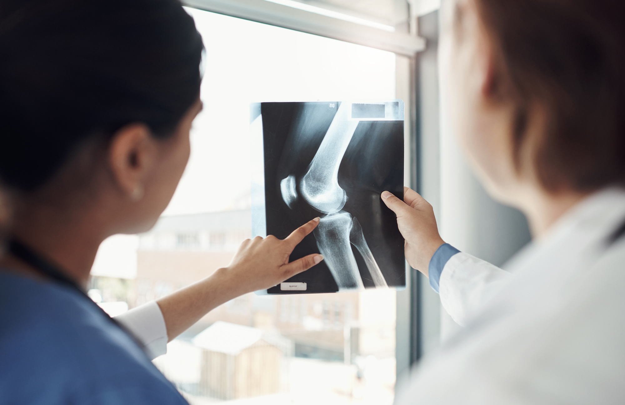 Ortoped pregleda MRI ali RTG posnetek – pri znakih rdeče aluči je treba izključiti strukturno poškodbo.